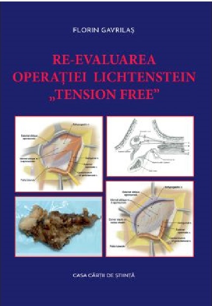 Re-evaluarea operatiei Lichtenstein „tension free” | Florin Gavrilas carturesti 2022
