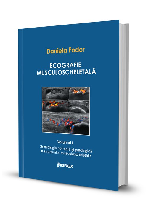 Ecografie musculoscheletala -Vol. I | Daniela Fodor carturesti.ro poza 2022