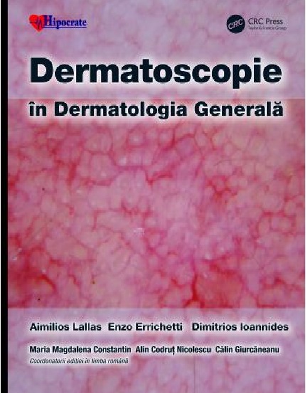 Dermatoscopie in Dermatologia Generala | Aimilios Lallas, Alin Codrut Nicolescu, Dimitrios Ioannides