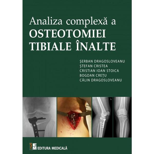 Analiza complexa a Osteotomiei Tibiale Inalte | Serban Dragosloveanu carturesti.ro imagine 2022 cartile.ro