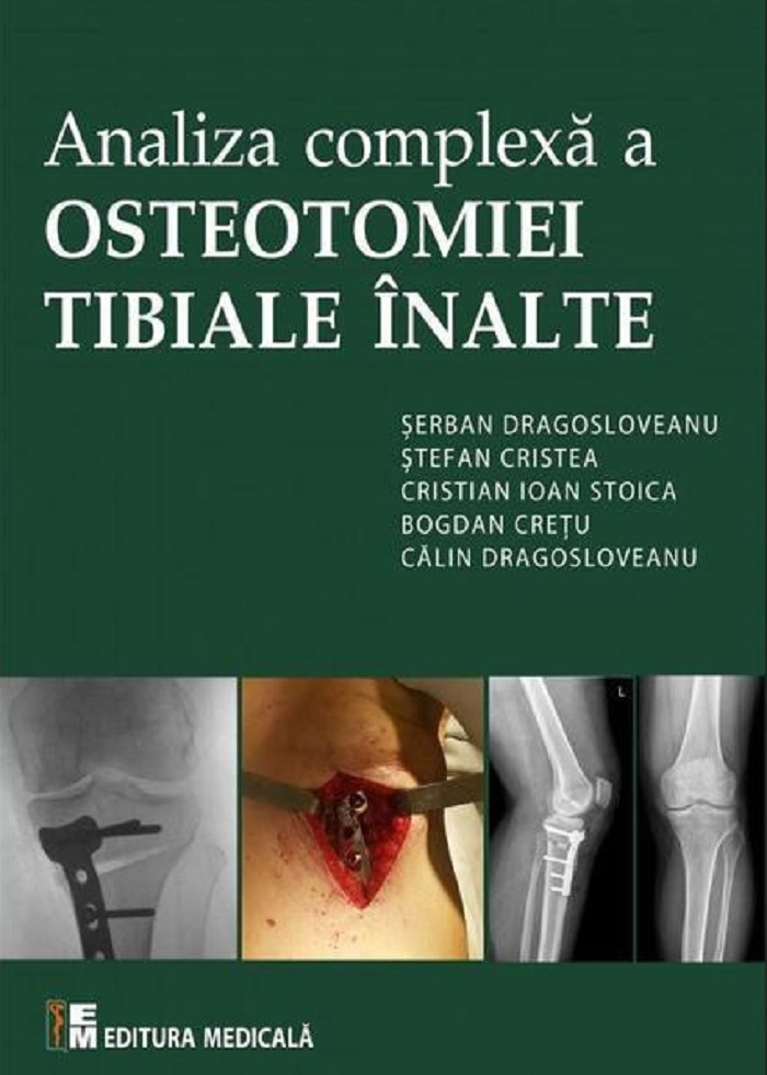 Analiza complexa a osteotomiei tibiale inalte | Serban Dragosloveanu carturesti.ro Carte