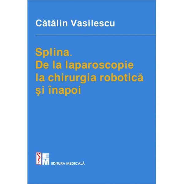 Splina | Catalin Vasilescu