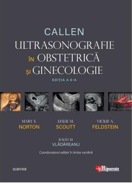Ultrasonografie in Obstetrica si Ginecologie | Mary Norton, Leslie Scoutt, Vickie Feldstein, Radu Vladareanu Carte