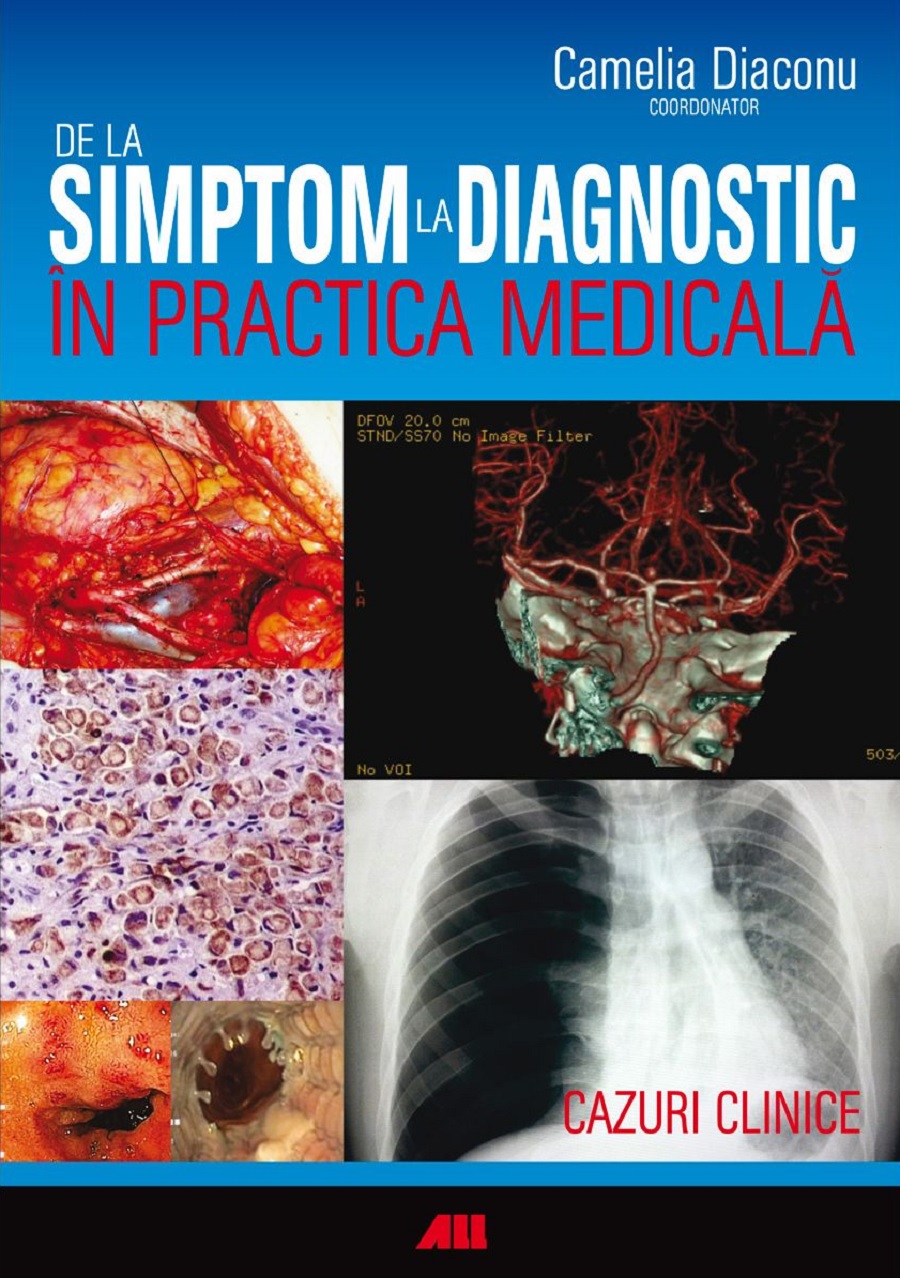 De la simptom la diagnostic in practica medicala | Diaconu Camelia