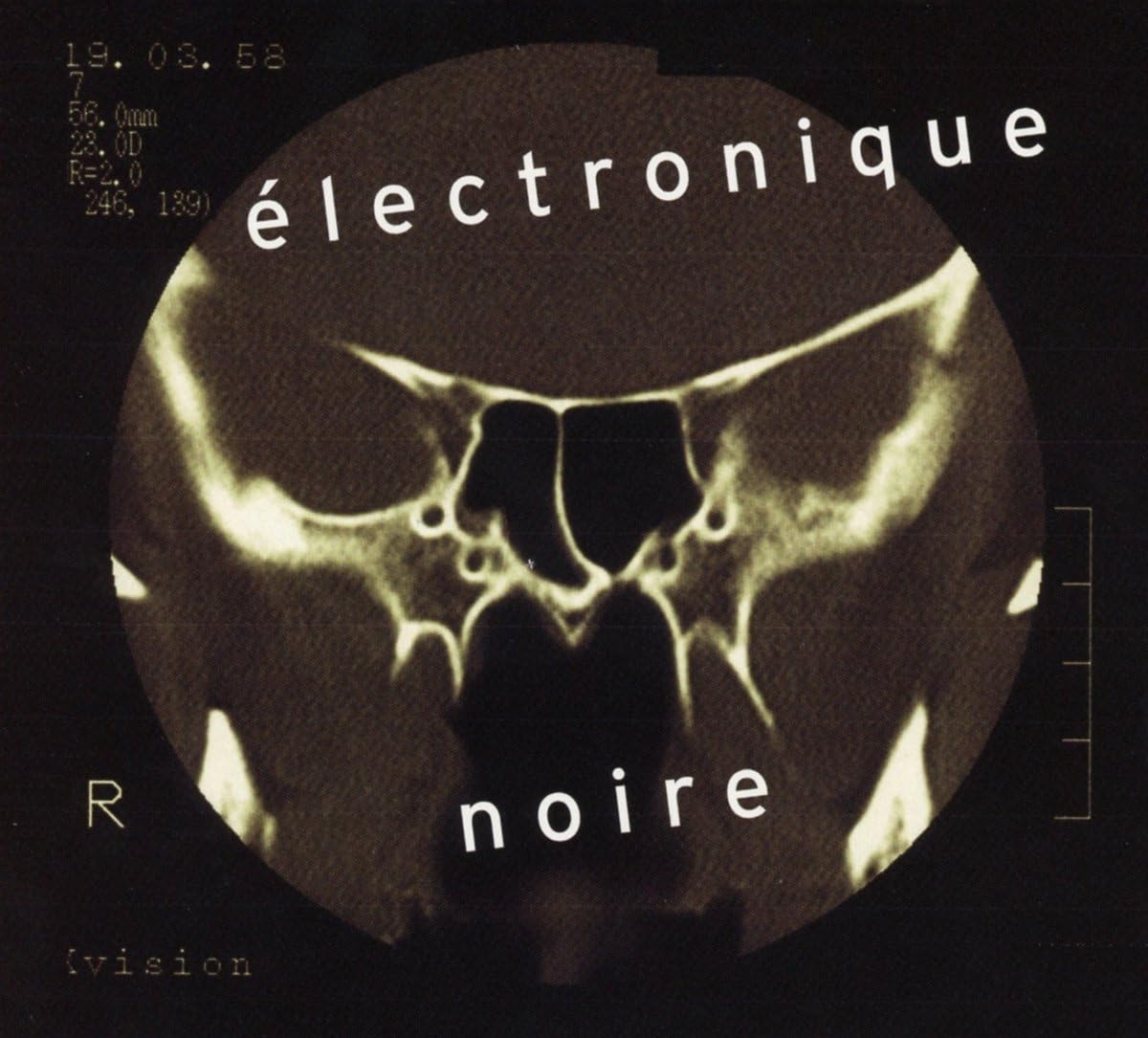 Electronique Noire | Eivind Aarset - 1 | YEO