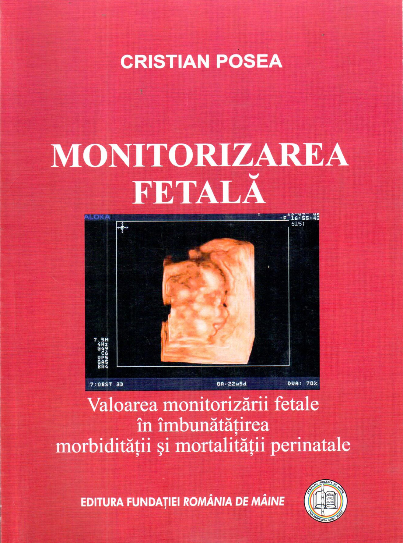 Monitorizarea fetala – Valoarea monitorizarii fetale in imbunatatirea morbiditatii si mortalitatii perinatale | Cristian Posea carturesti 2022