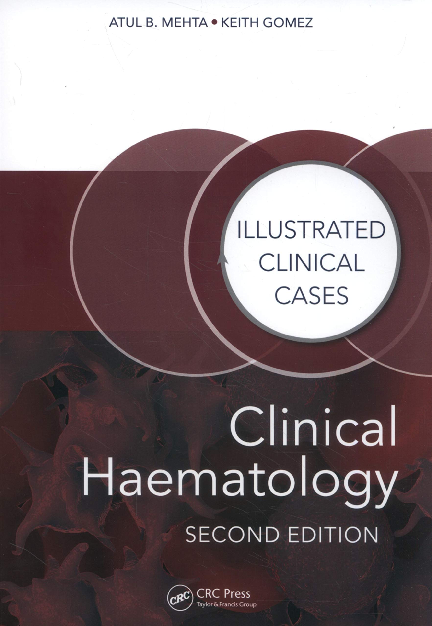 Vezi detalii pentru Clinical Haematology | Atul Bhanu Mehta, Keith Gomez