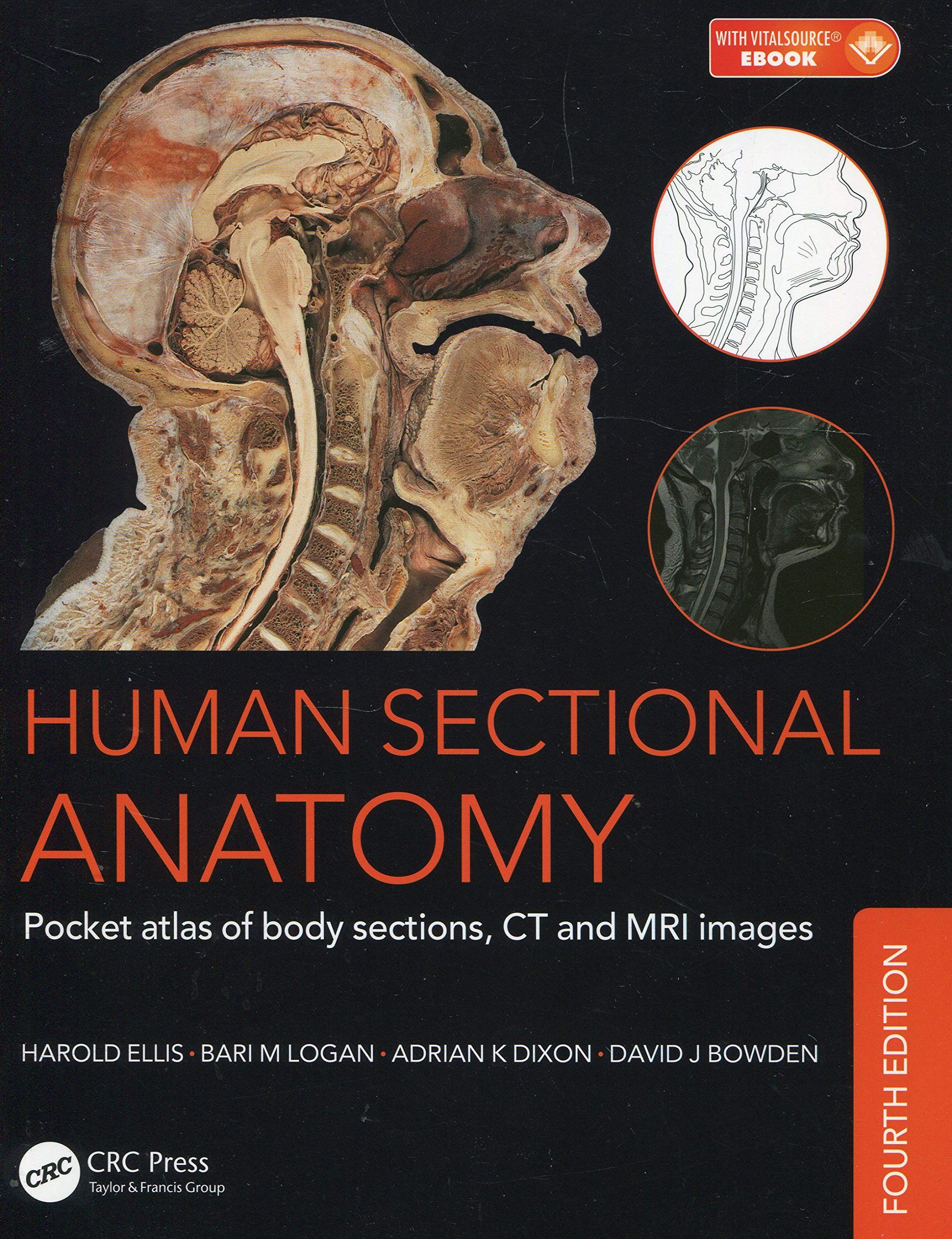 Human Sectional Anatomy | Adrian Kendal Dixon, Bari M. Logan, David J. Bowden