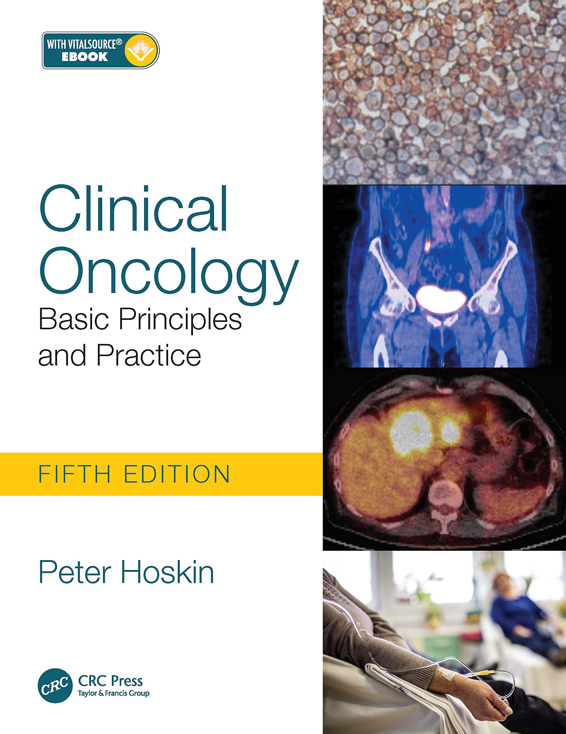 Clinical Oncology | Peter Hoskin