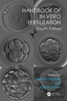 Handbook of in Vitro Fertilization |