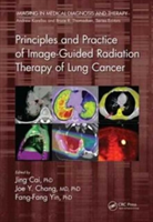 Principles and Practice of Image-Guided Radiation Therapy of Lung Cancer |