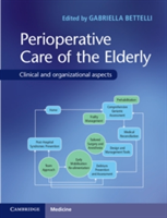 Perioperative Care of the Elderly |