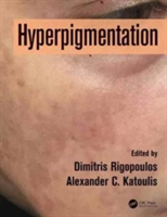 Hyperpigmentation |