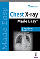 Chest X-ray Made Easy | D. Karthikeyan, Deepa Chegu