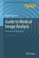 Guide to Medical Image Analysis | Klaus D. Toennies