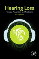 Hearing Loss | Canada) University of Calgary and Psychology Pharmacology Jos J. (Departments of Physiology Eggermont