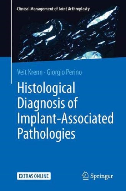 Histological Diagnosis of Implant-associated Pathologies | Veit Krenn, Giorgio Perino