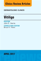 Vitiligo, An Issue of Dermatologic Clinics | John E. Harris
