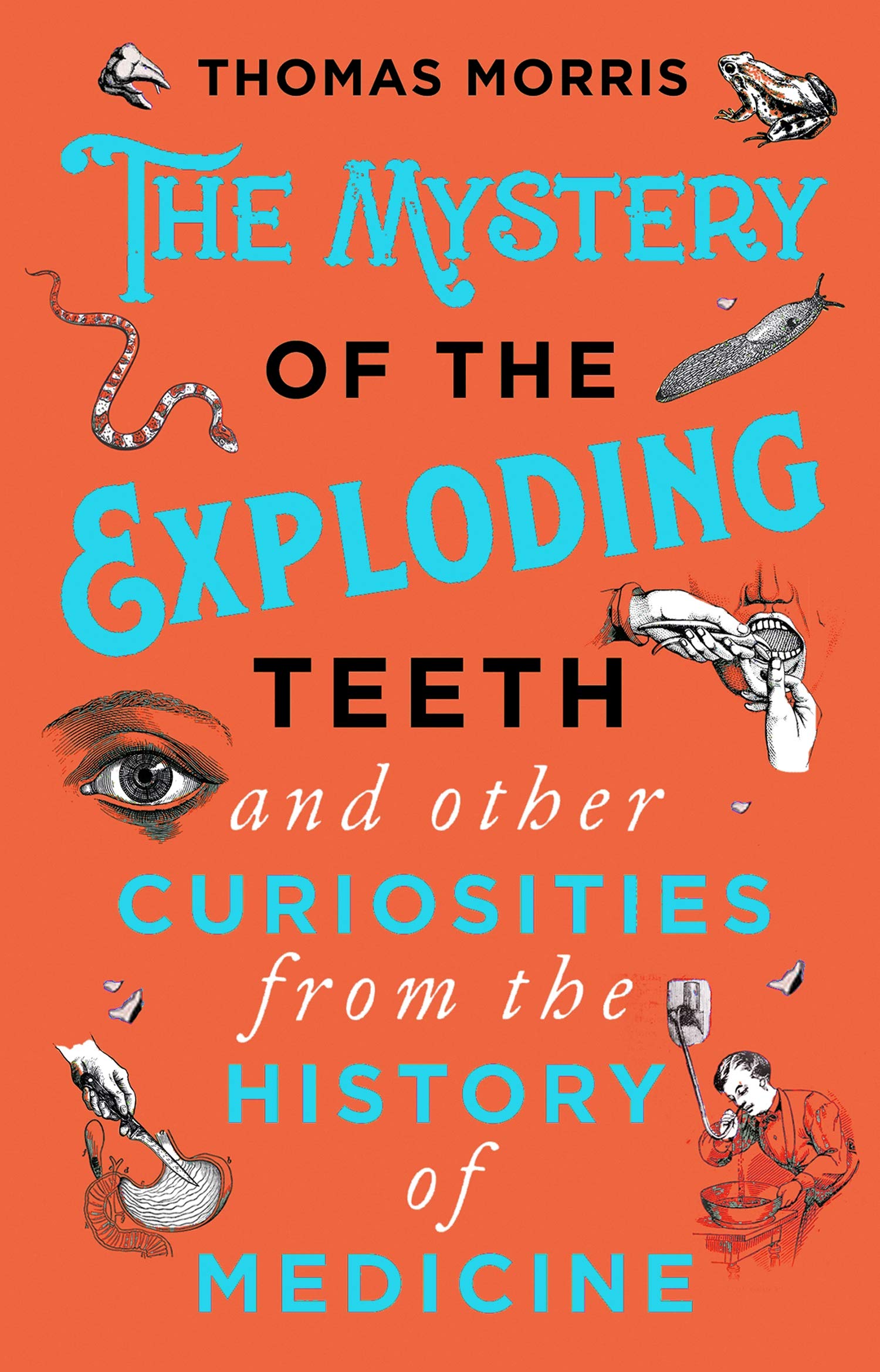 Mystery of the Exploding Teeth and Other Curiosities from the History of Medicine | Thomas Morris