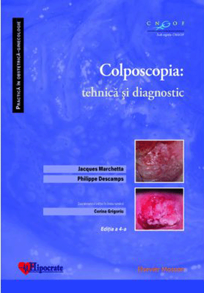 Colposcopia: tehnica si diagnostic | Jacques Marchetta, Philippe Descamps carturesti.ro