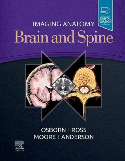 Imaging Anatomy Brain and Spine | Osborn, Salzman, Anderson, Toga, Law, Ross, Moore