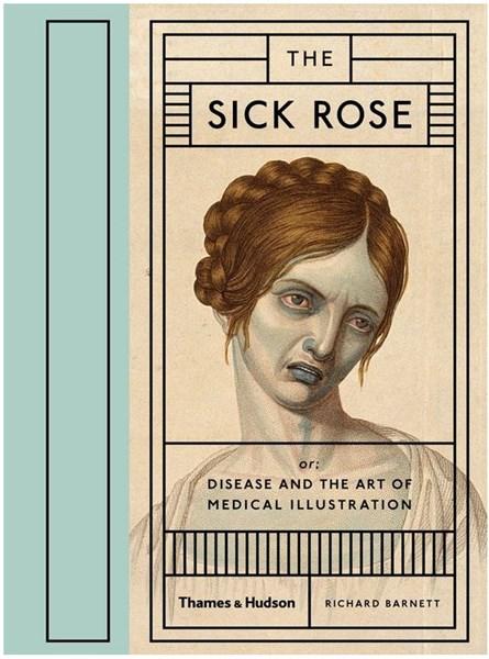 The Sick Rose | Richard Barnett